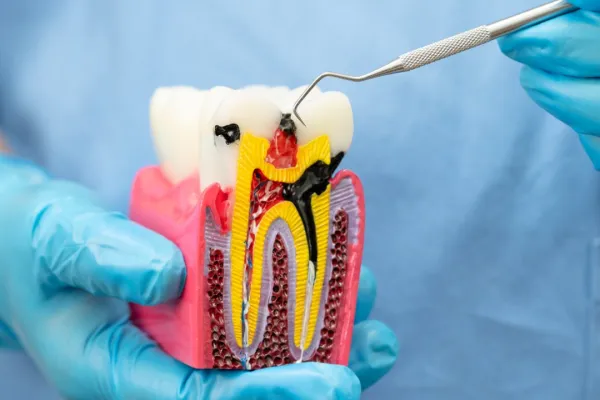 asian-dentist-holding-dental-implant-artificial-t-2025-04-03-18-46-07-utc-682301619030d